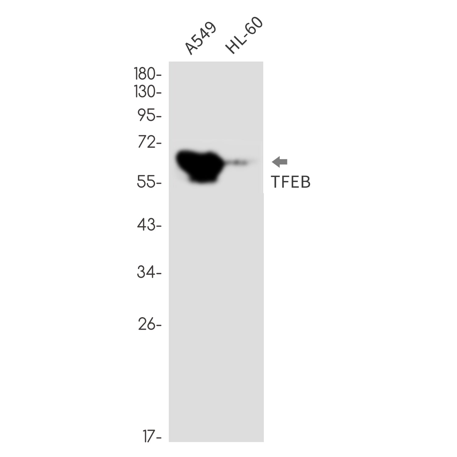 Anti-Transcription Factor EB Rabbit Monoclonal Antibody