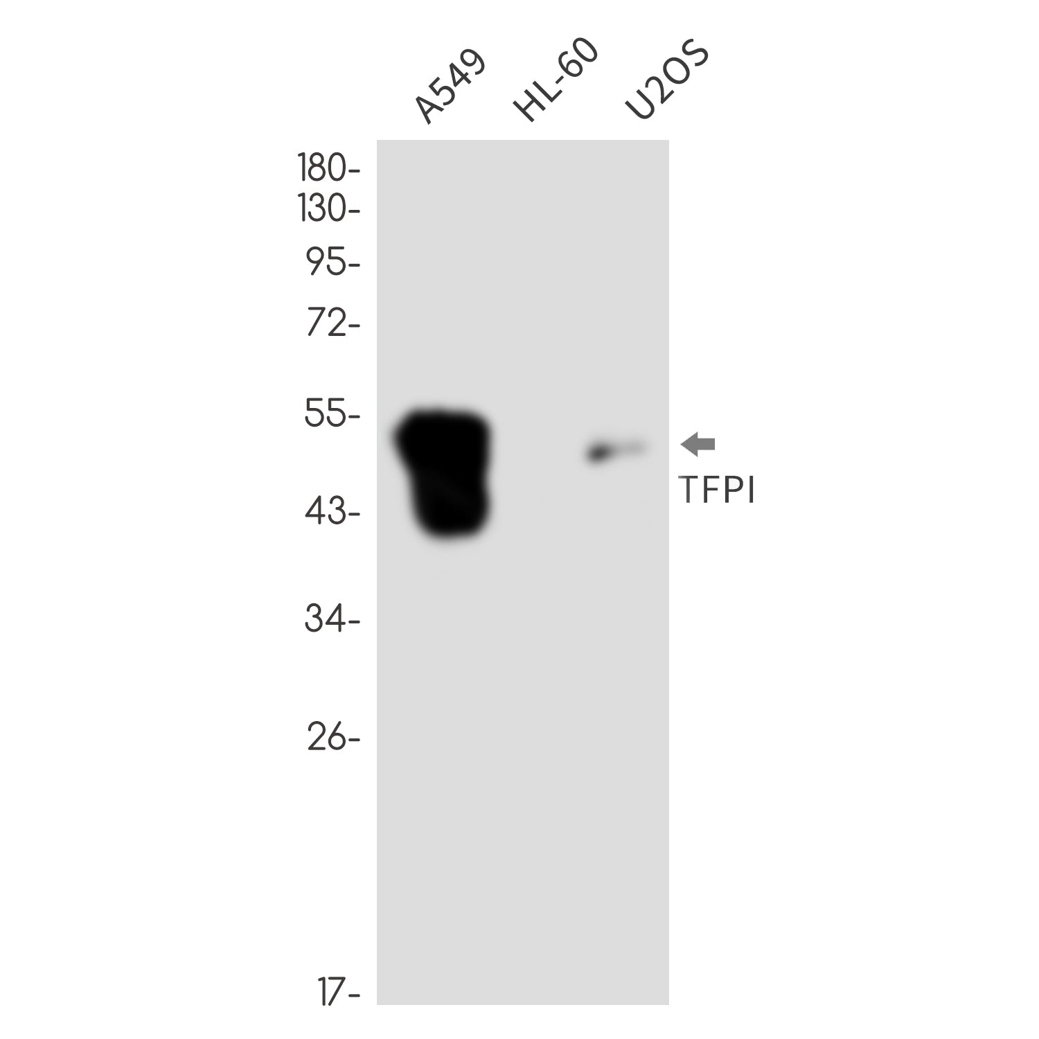 Anti-Tissue Factor Pathway Inhibitor Rabbit Monoclonal Antibody