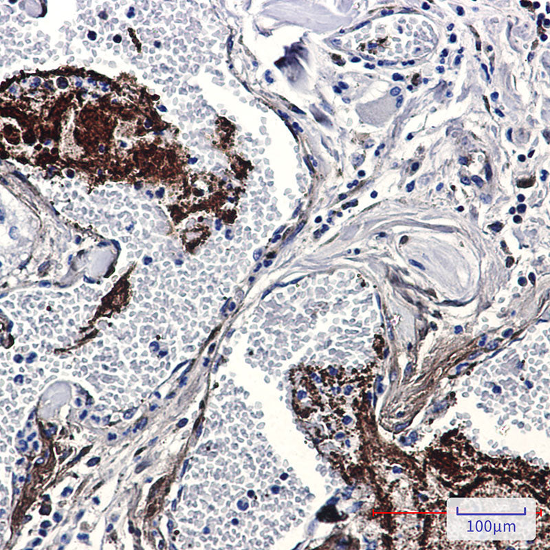 Anti-Thrombospondin 1 Rabbit Monoclonal Antibody