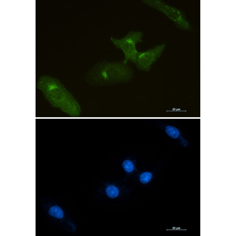 Anti-Tissue Factor Rabbit Monoclonal Antibody