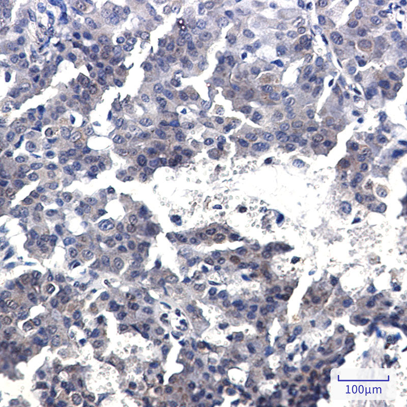 Anti-CREB Regulated Transcription Coactivator 2 Rabbit Monoclonal Antibody