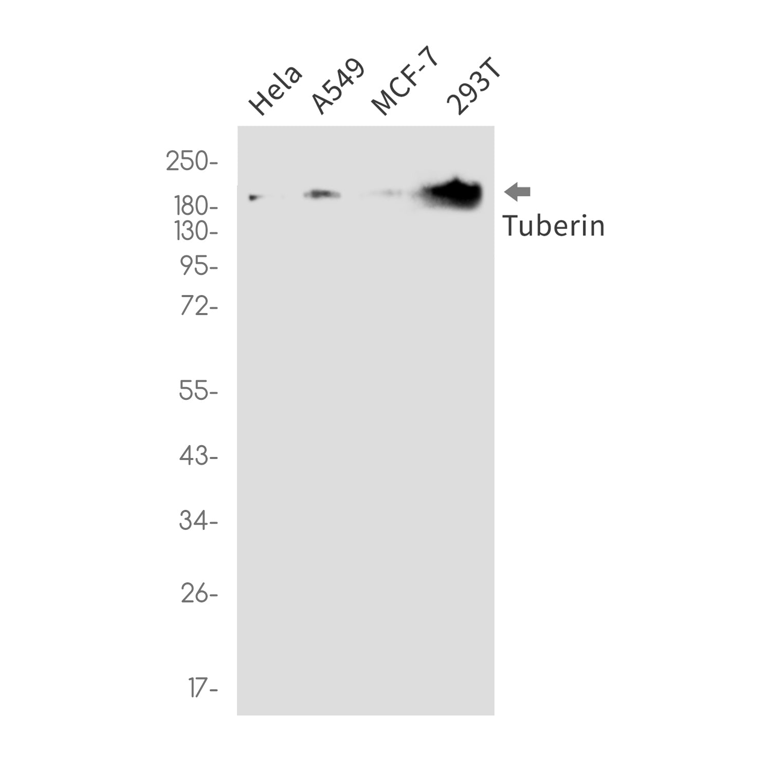 Anti-Tuberin Rabbit Monoclonal Antibody