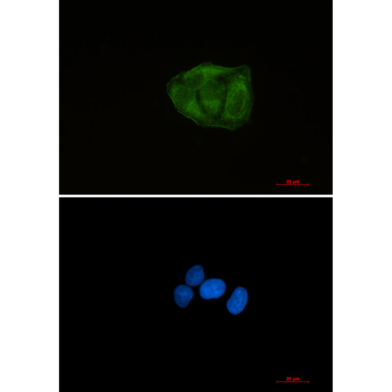 Anti-Ubiquitin 60S Ribosomal Protein L40 Rabbit Monoclonal Antibody