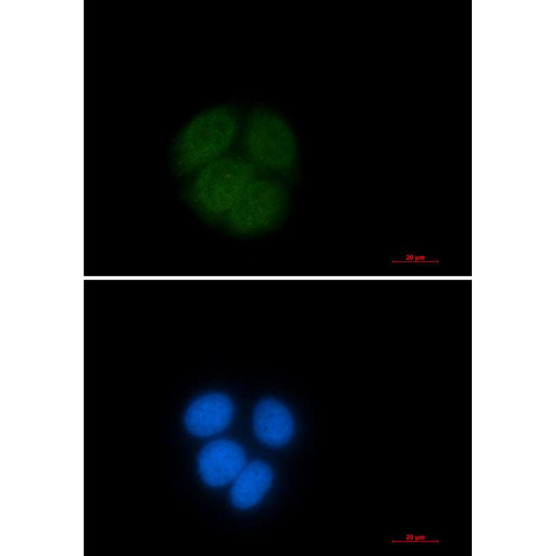 Anti-Ubiquitin Conjugating Enzyme E2 C Rabbit Monoclonal Antibody