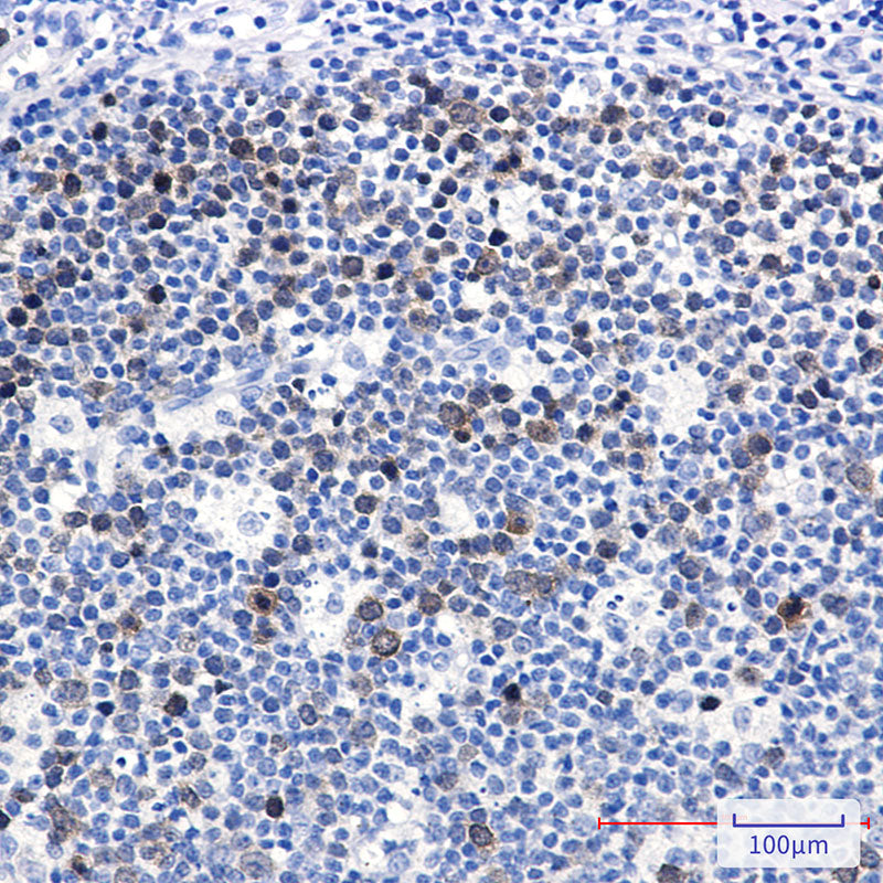 Anti-Ubiquitin Conjugating Enzyme E2 C Rabbit Monoclonal Antibody