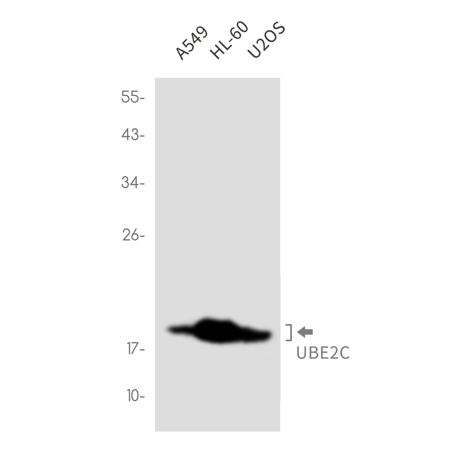 Anti-Ubiquitin Conjugating Enzyme E2 C Rabbit Monoclonal Antibody