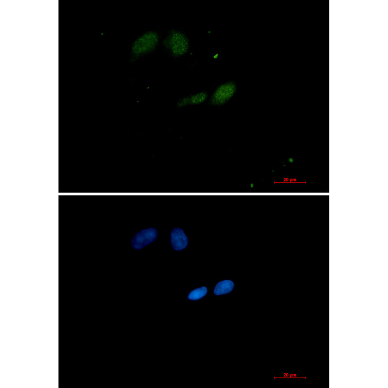 Anti-SUMO Conjugating Enzyme UBC9 Rabbit Monoclonal Antibody