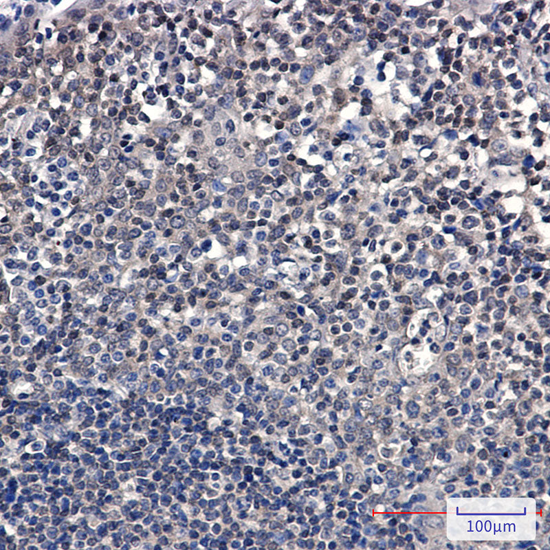 Anti-SUMO Conjugating Enzyme UBC9 Rabbit Monoclonal Antibody