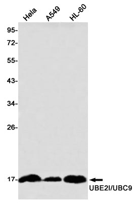 Anti-SUMO Conjugating Enzyme UBC9 Rabbit Monoclonal Antibody