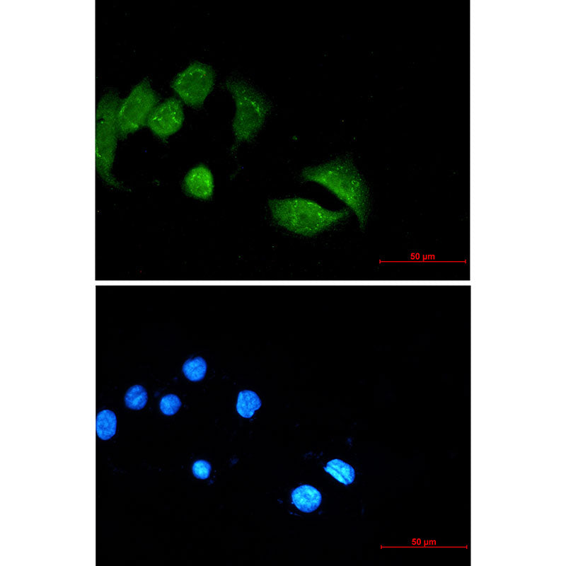 Anti-Ubiquitin Conjugation Factor E4 B Rabbit Monoclonal Antibody