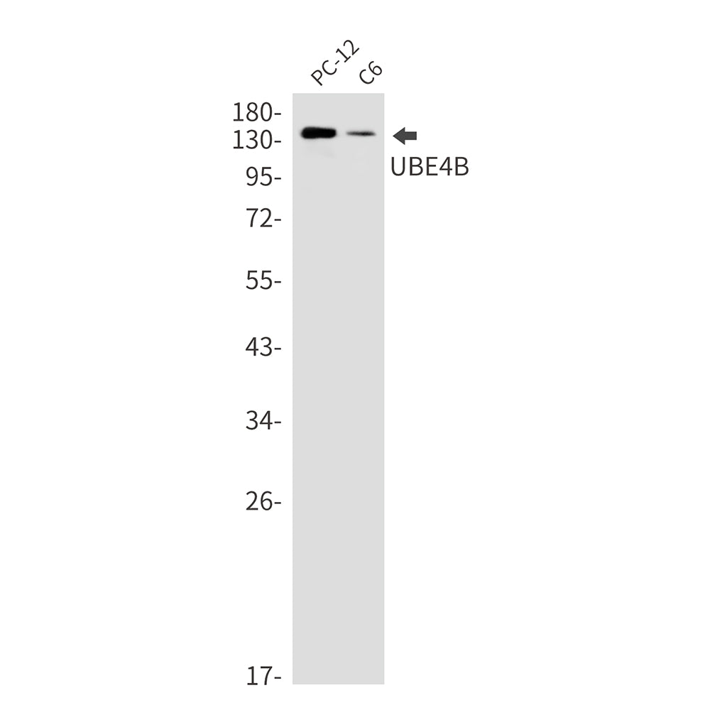 Anti-Ubiquitin Conjugation Factor E4 B Rabbit Monoclonal Antibody