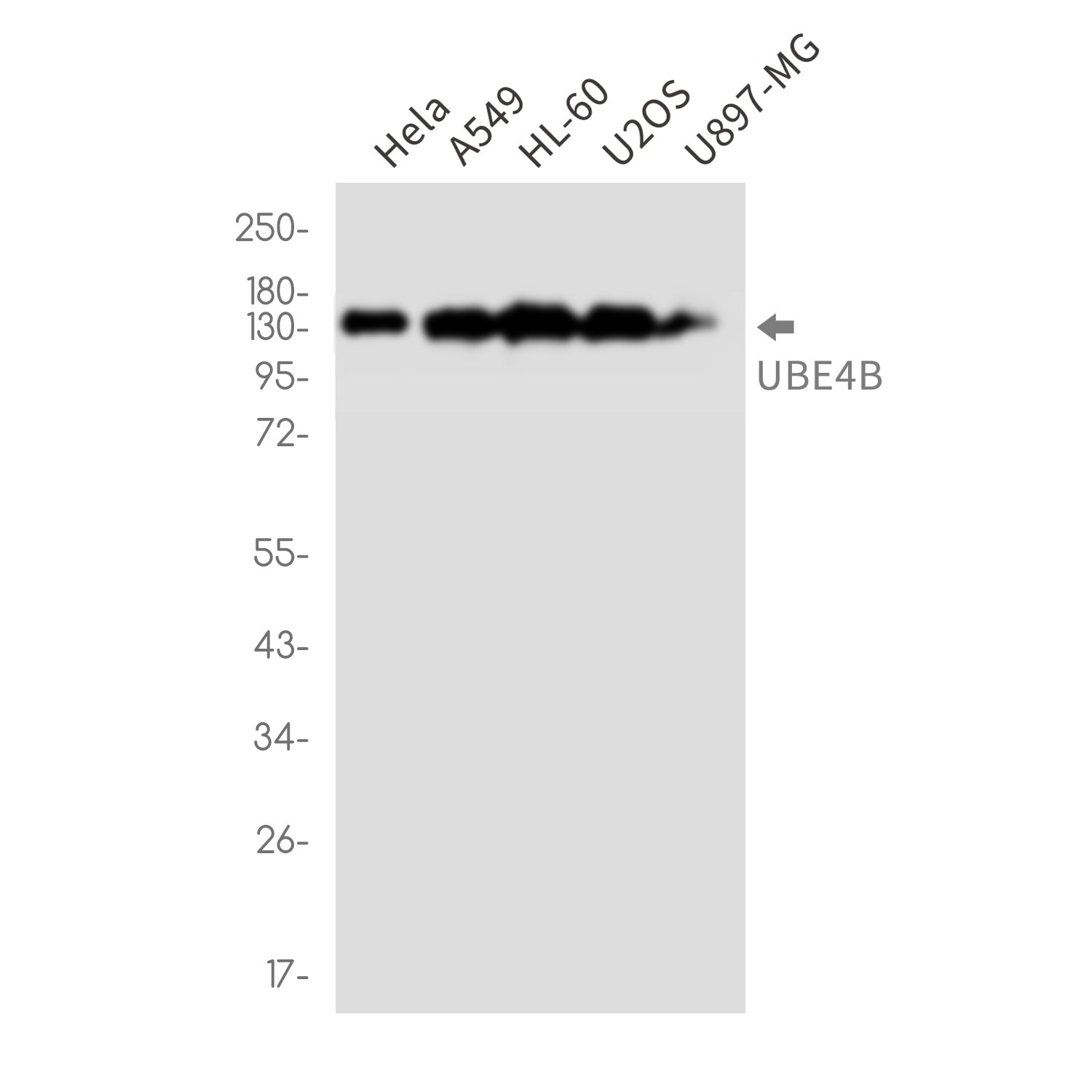 Anti-Ubiquitin Conjugation Factor E4 B Rabbit Monoclonal Antibody