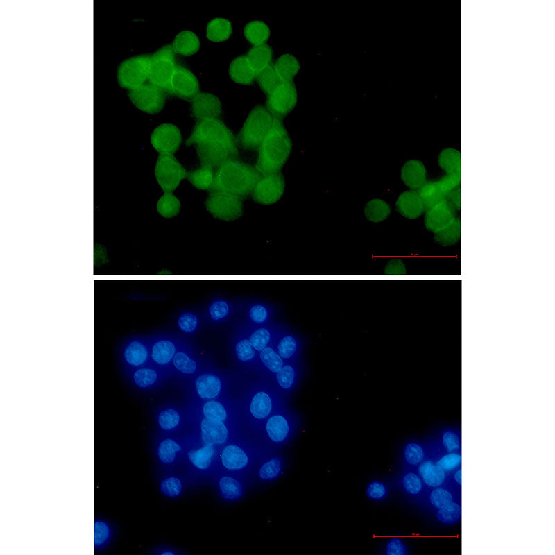 Anti-Ubiquitin K63 Rabbit Monoclonal Antibody