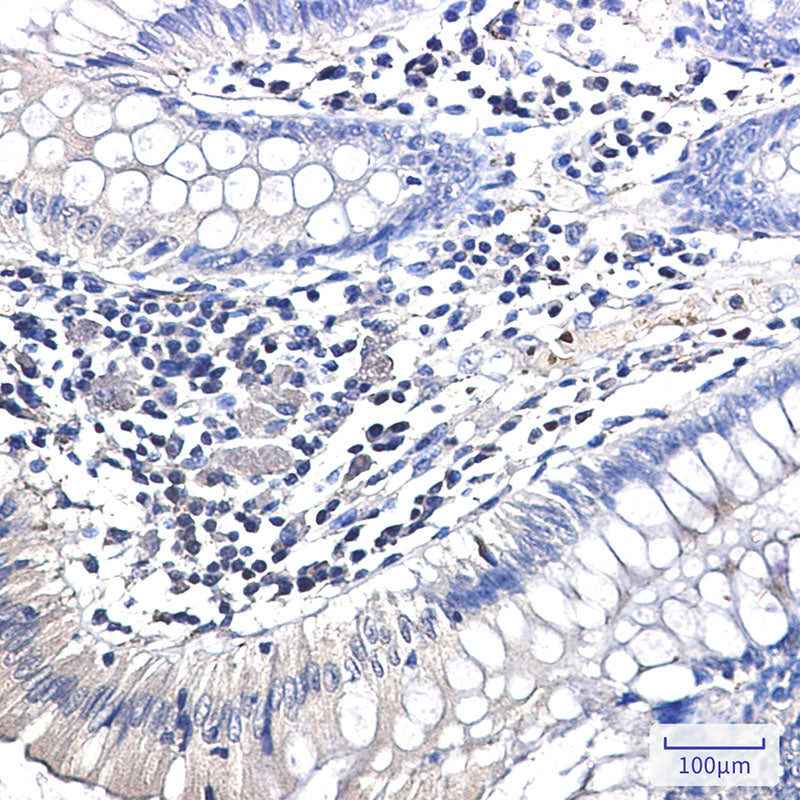 Anti-Ubiquitin K63 Rabbit Monoclonal Antibody