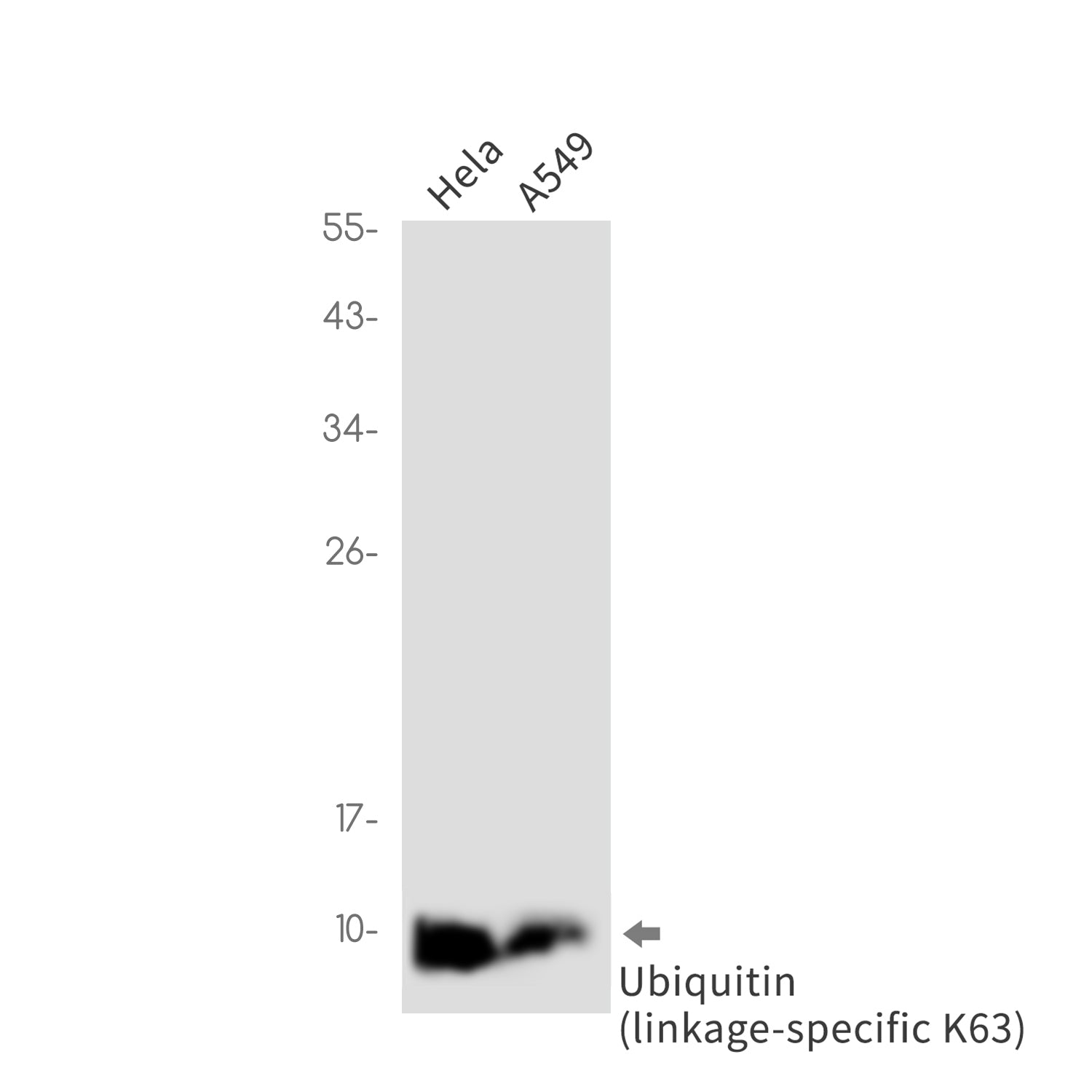 Anti-Ubiquitin K63 Rabbit Monoclonal Antibody