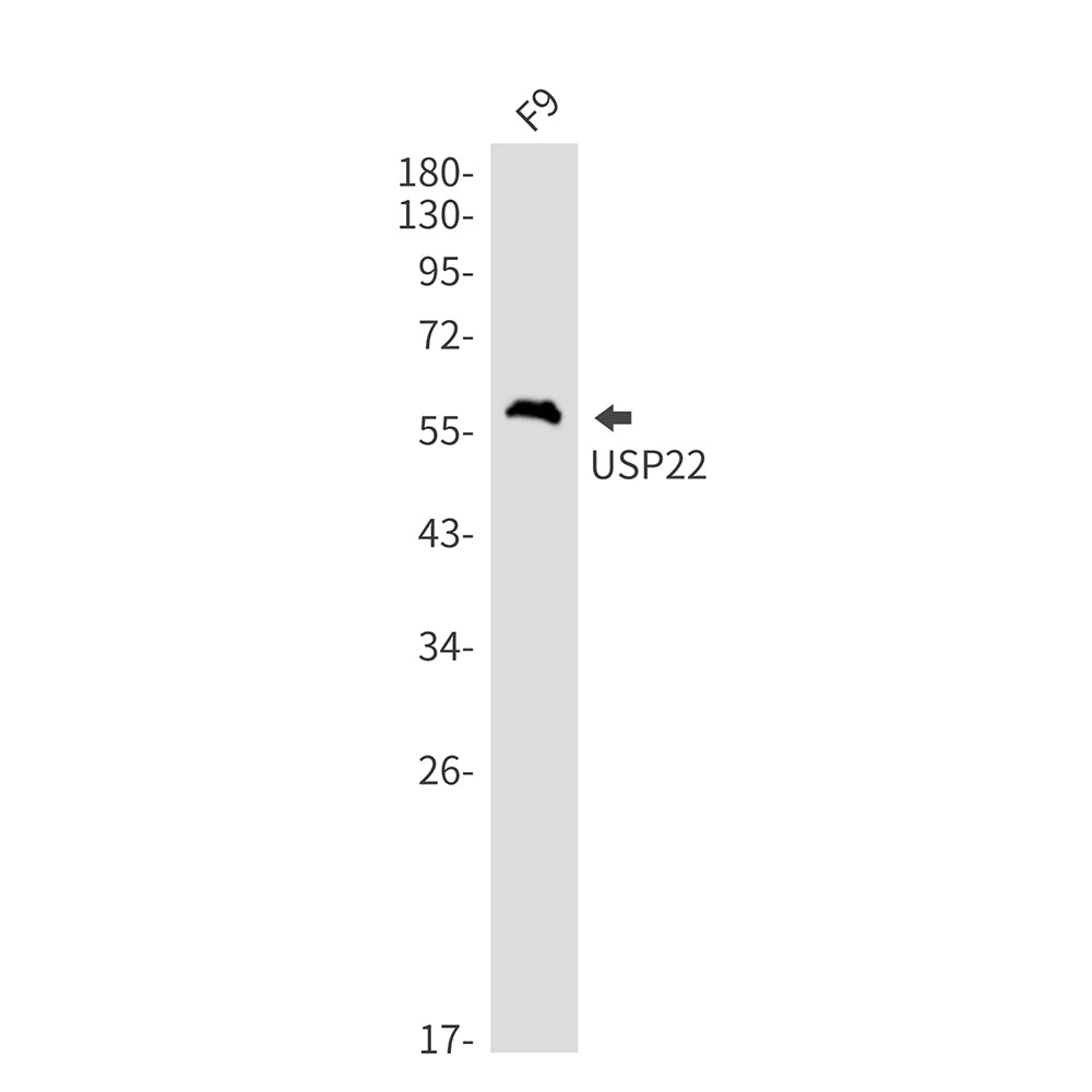 Anti-USP22 Rabbit Monoclonal Antibody