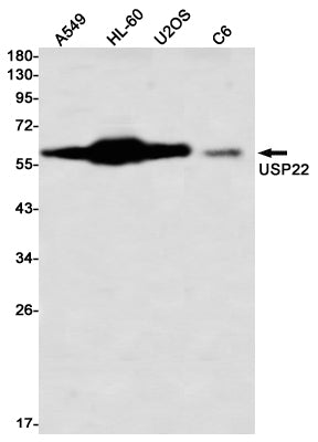 Anti-USP22 Rabbit Monoclonal Antibody