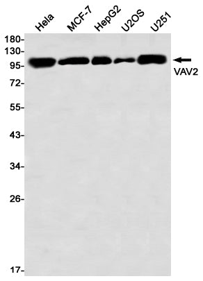Anti-VAV2 Rabbit Monoclonal Antibody