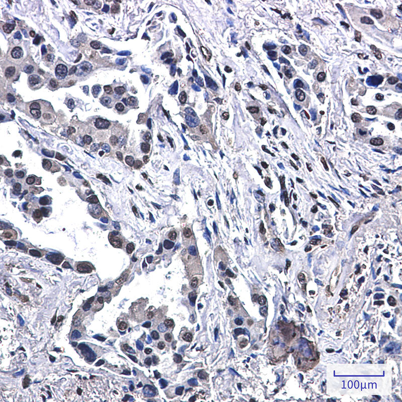 Anti-VPS35 Rabbit Monoclonal Antibody