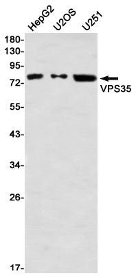 Anti-VPS35 Rabbit Monoclonal Antibody