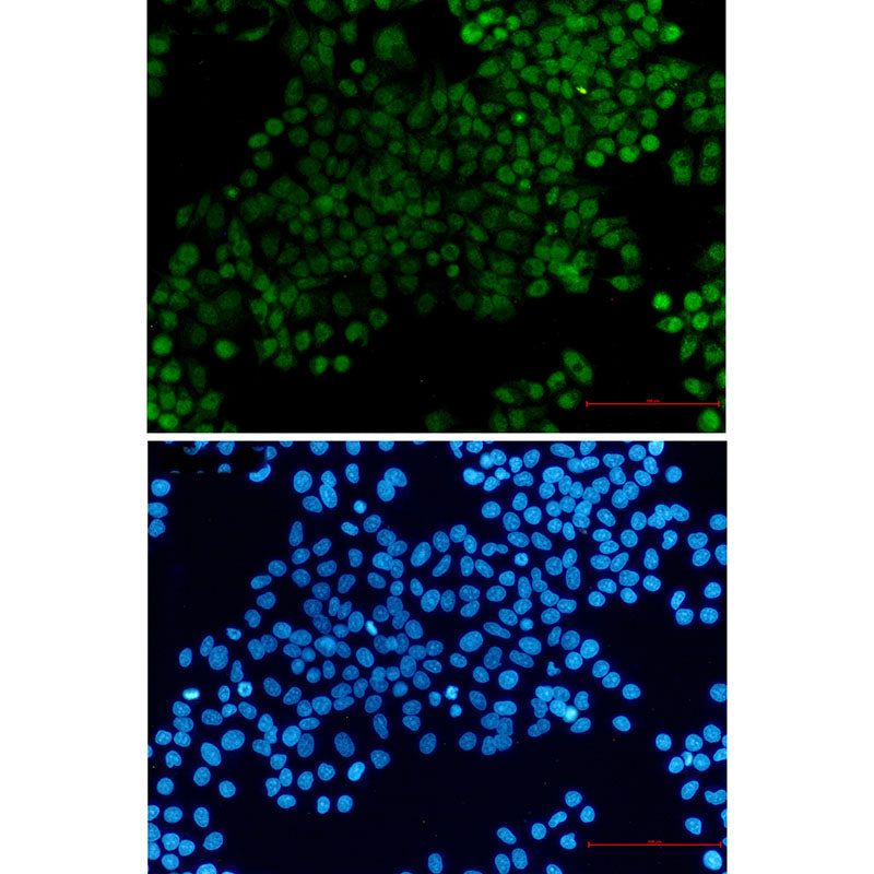 Anti-XRCC1 Rabbit Monoclonal Antibody