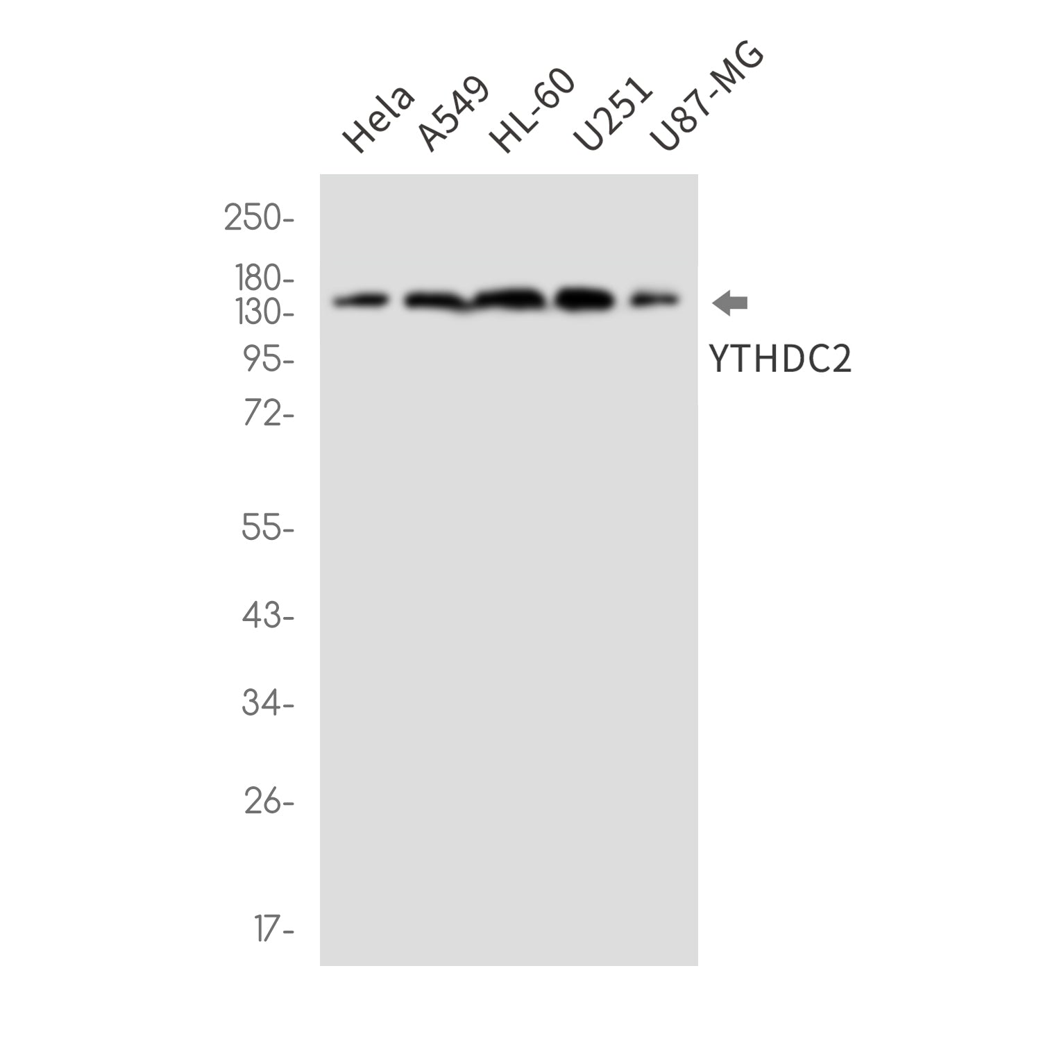 Anti-YTHDC2 Rabbit Monoclonal Antibody