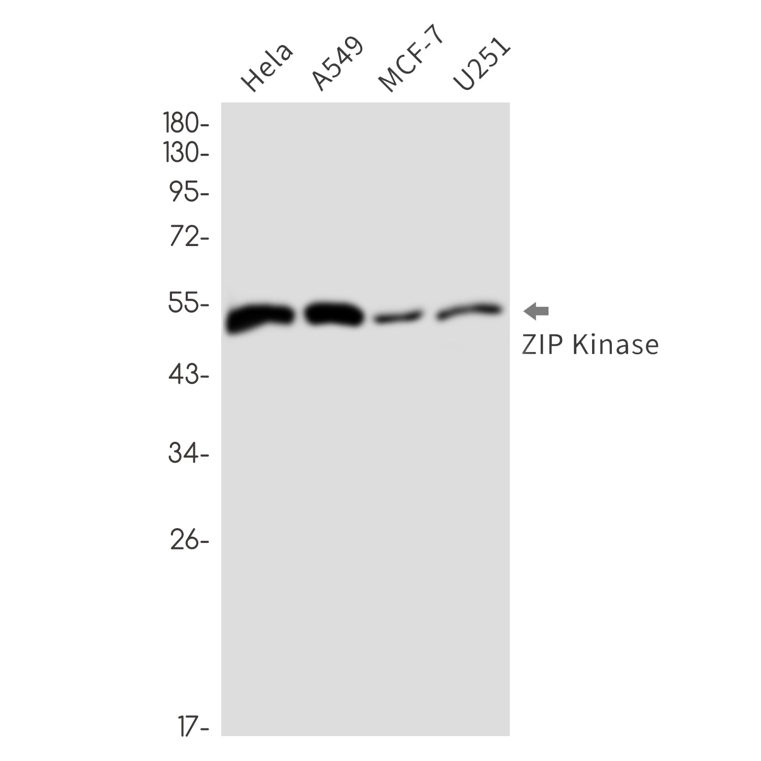 Anti-DAP kinase 3 Rabbit Monoclonal Antibody
