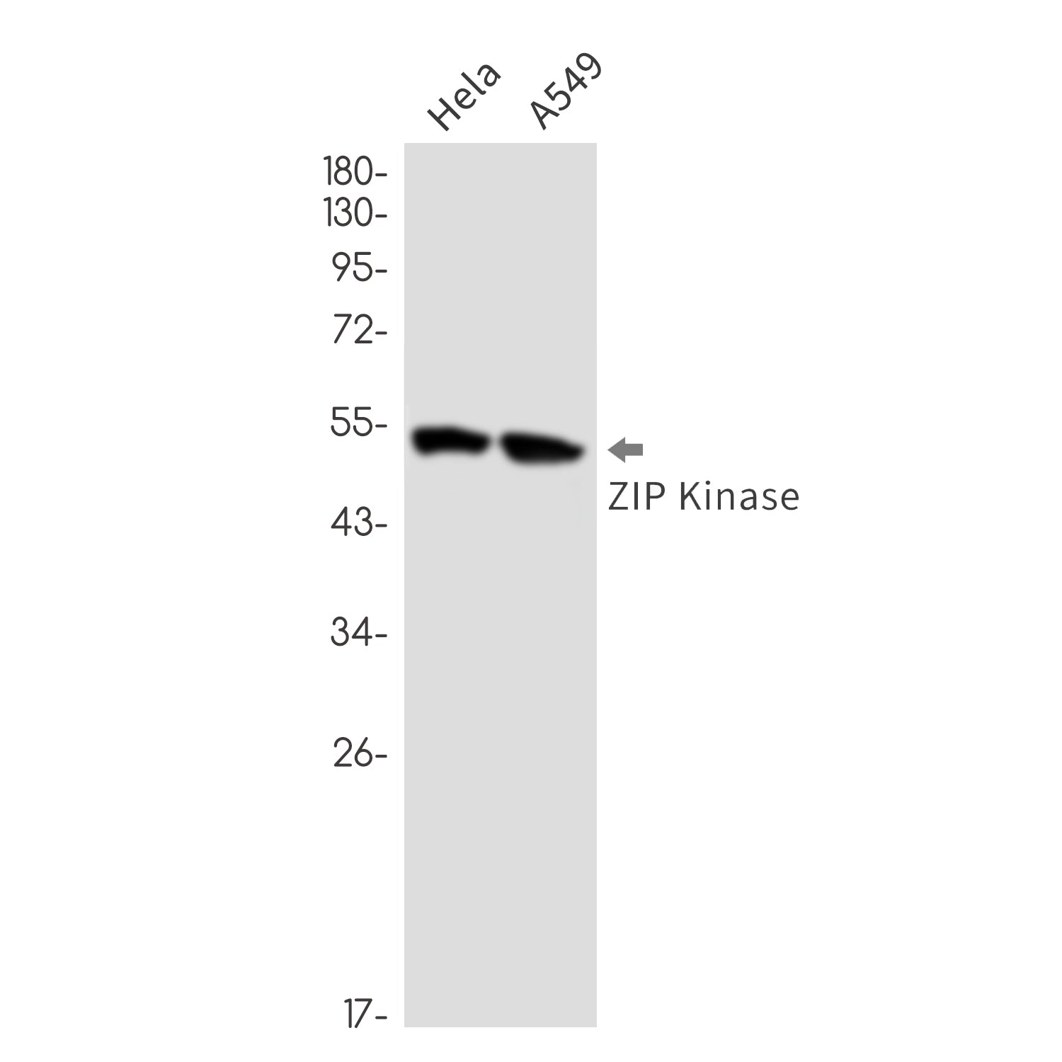 Anti-DAP kinase 3 Rabbit Monoclonal Antibody