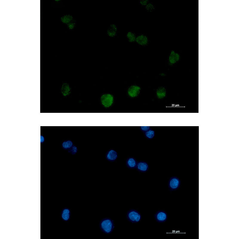 Anti-PKC beta 2 Rabbit Monoclonal Antibody
