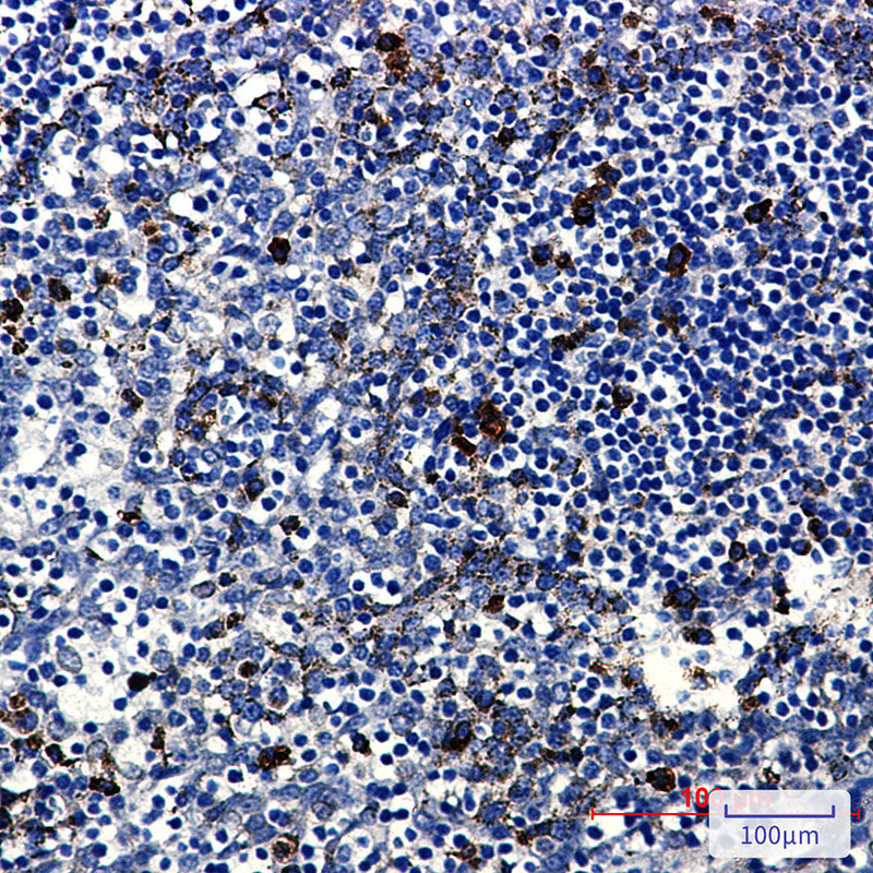 Anti-PKC beta 2 Rabbit Monoclonal Antibody