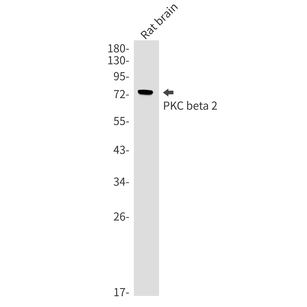 Anti-PKC beta 2 Rabbit Monoclonal Antibody