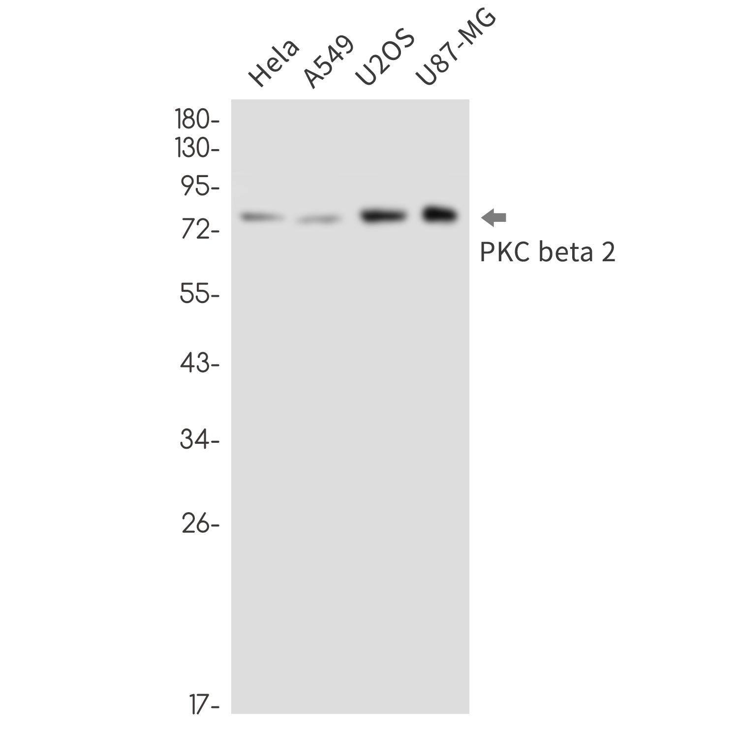 Anti-PKC beta 2 Rabbit Monoclonal Antibody