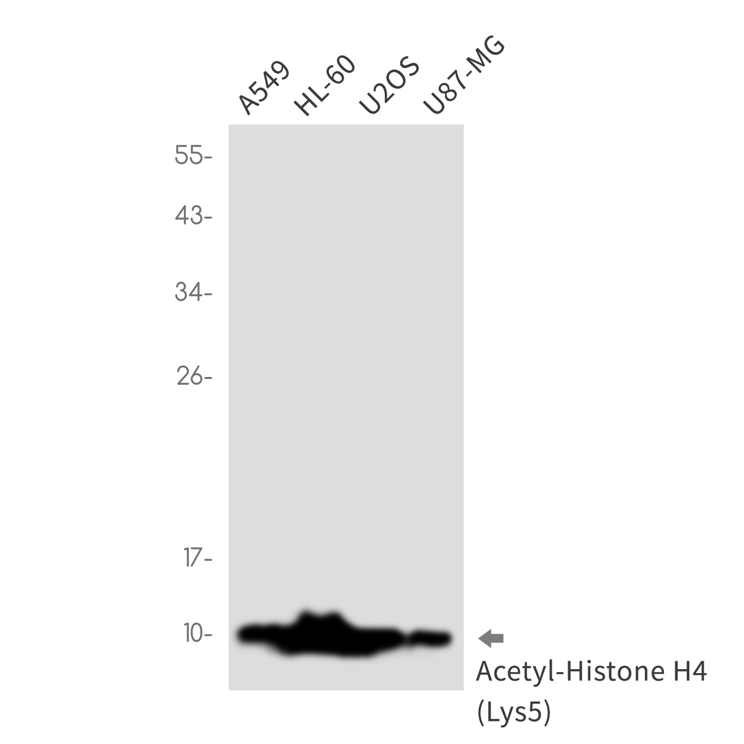 Anti-Acetyl-Histone H4 (Lys5) Rabbit Monoclonal Antibody