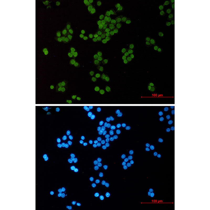 Anti-Acetyl-Histone H3 (Lys14) Rabbit Monoclonal Antibody