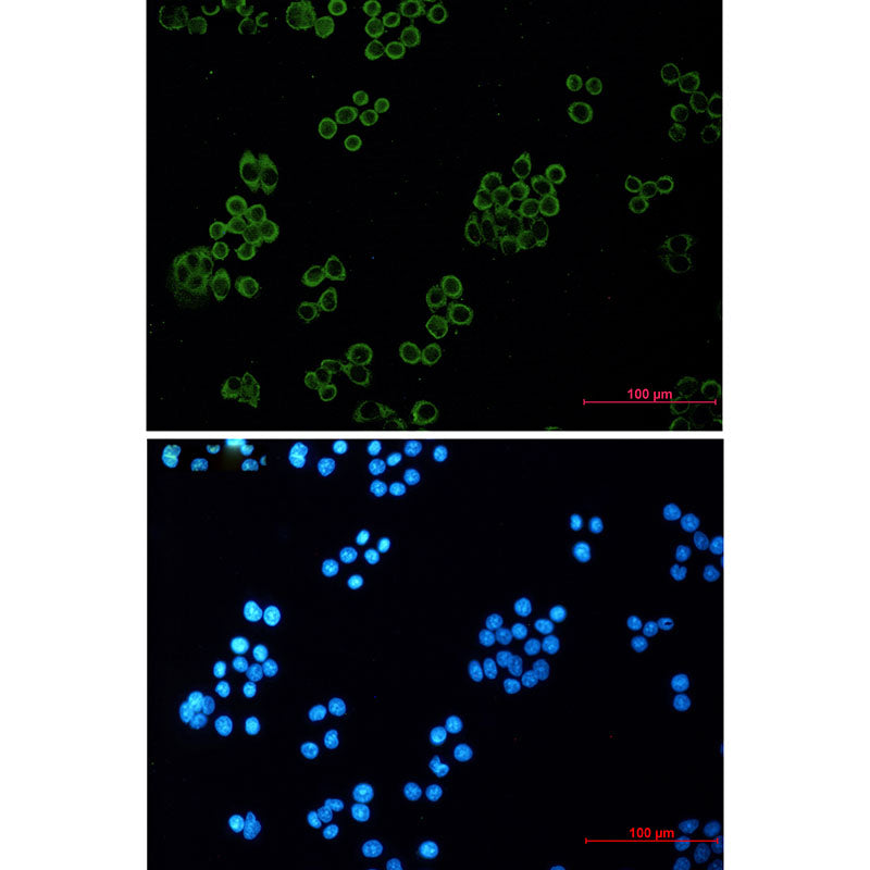 Anti-Human kappa Light Chain Rabbit Monoclonal Antibody
