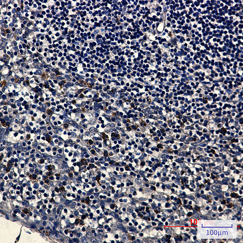 Anti-Human kappa Light Chain Rabbit Monoclonal Antibody