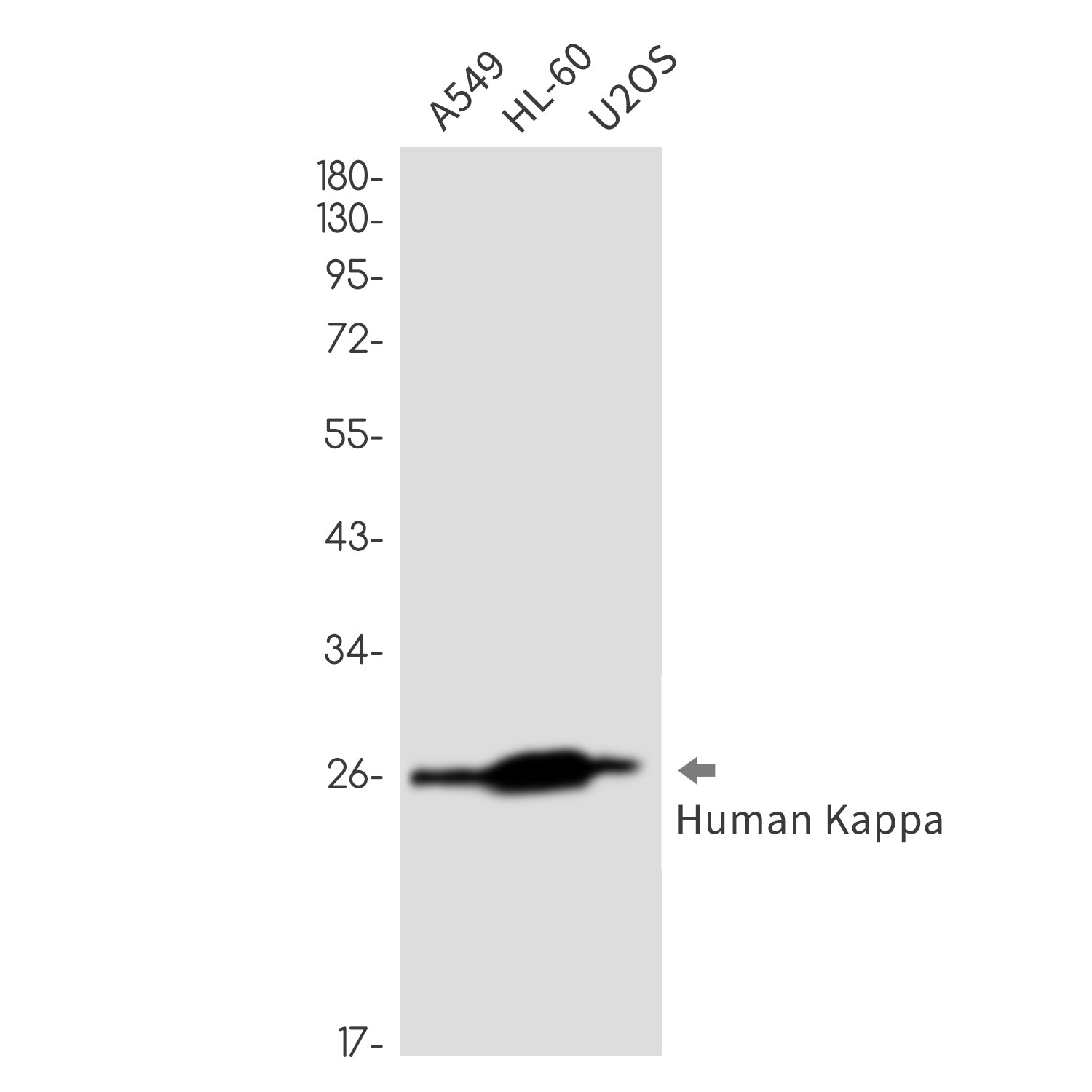 Anti-Human kappa Light Chain Rabbit Monoclonal Antibody