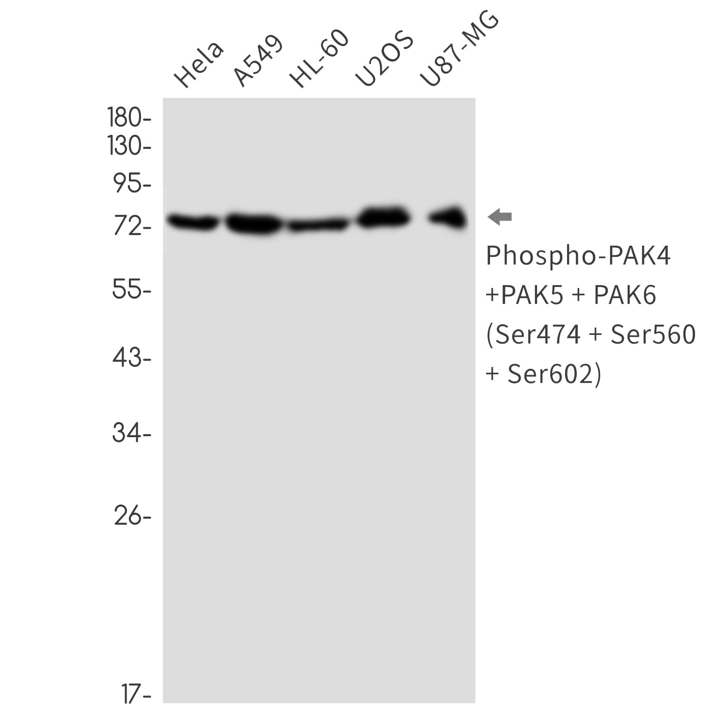 Anti-Phospho-PAK4/5/6 (Ser474/Ser560/Ser602) Rabbit Monoclonal Antibody