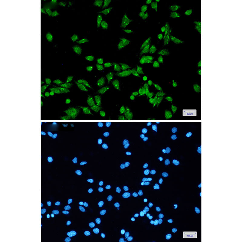Anti-PRPF31 Rabbit Monoclonal Antibody
