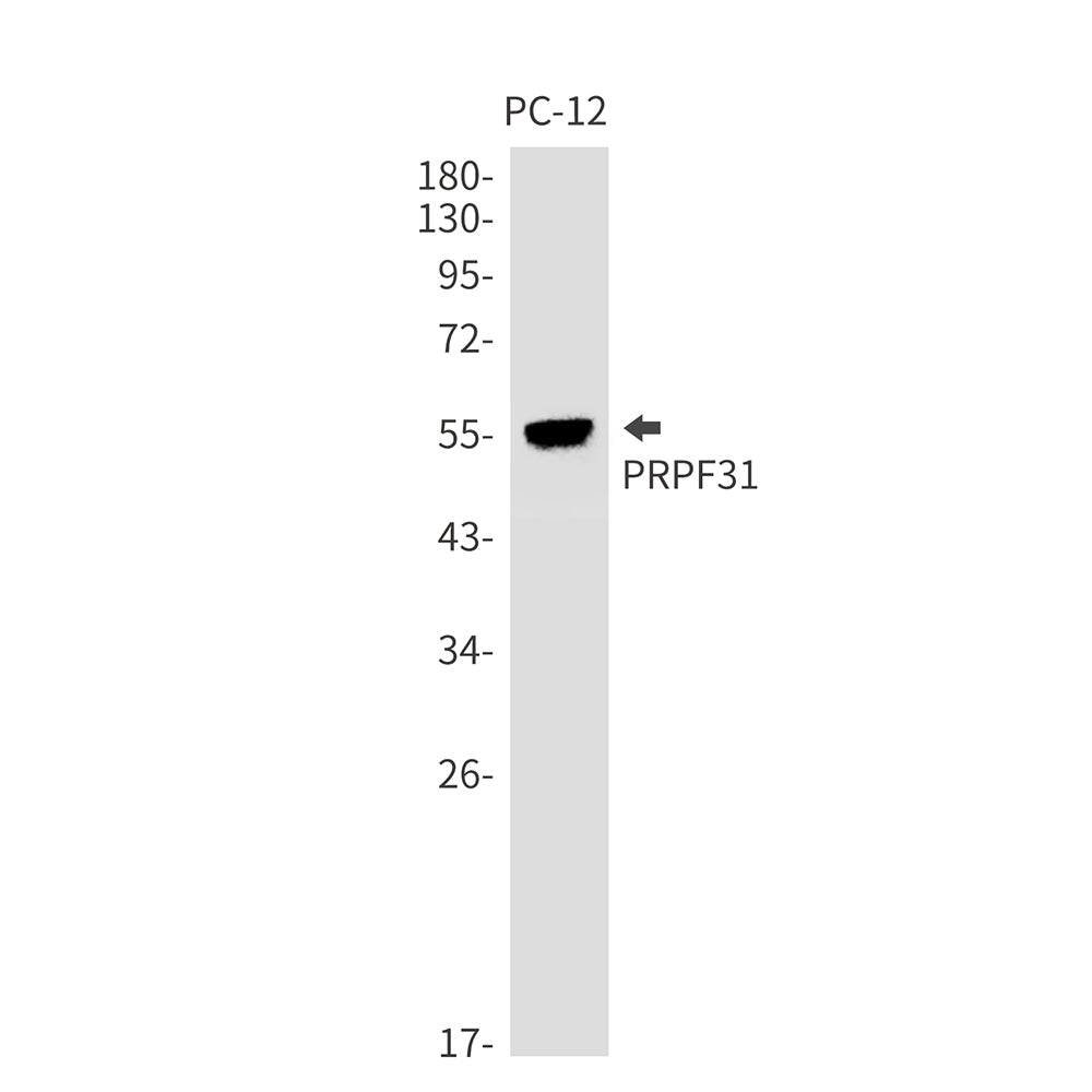 Anti-PRPF31 Rabbit Monoclonal Antibody