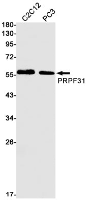 Anti-PRPF31 Rabbit Monoclonal Antibody