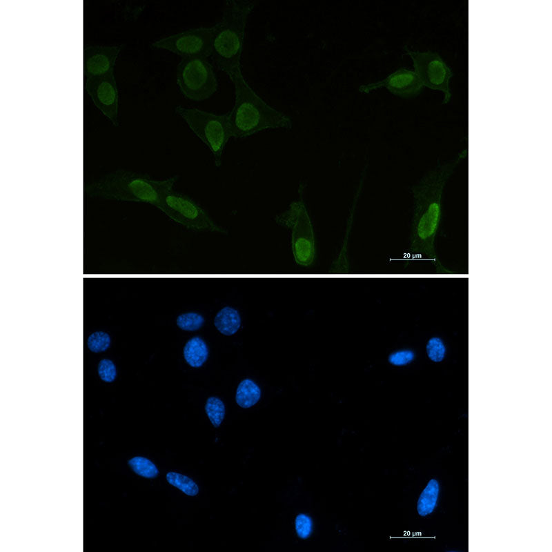 Anti-Acetyl-p53 (Lys370) Rabbit Monoclonal Antibody