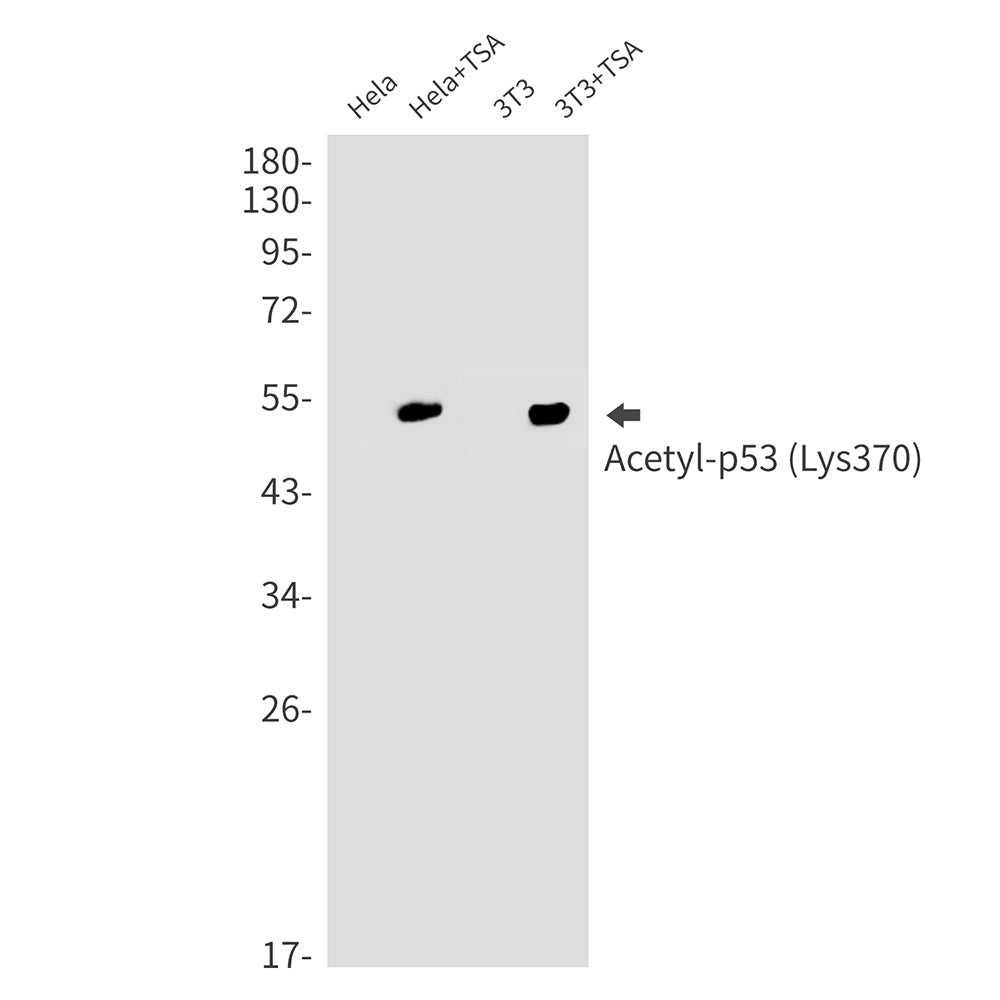 Anti-Acetyl-p53 (Lys370) Rabbit Monoclonal Antibody