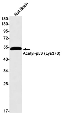 Anti-Acetyl-p53 (Lys370) Rabbit Monoclonal Antibody