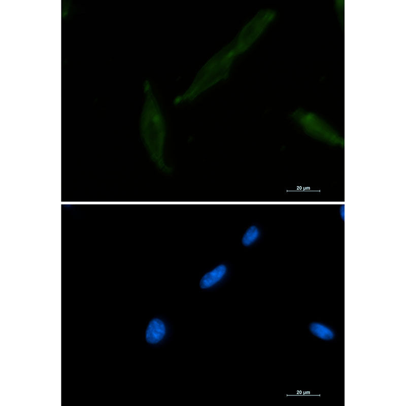 Anti-CD147 Rabbit Monoclonal Antibody