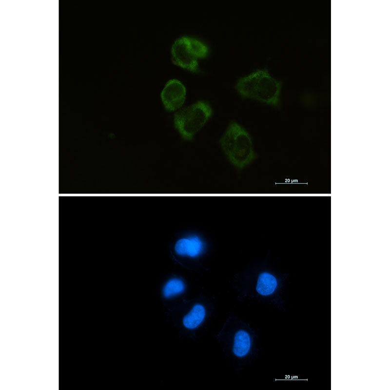 Anti-Lysozyme Rabbit Monoclonal Antibody