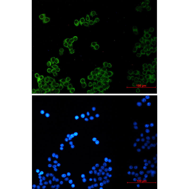 Anti-Phospholipase A2 Activator Protein Rabbit Monoclonal Antibody