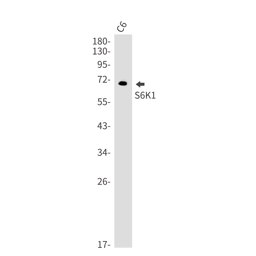 Anti-S6K1 Rabbit Monoclonal Antibody