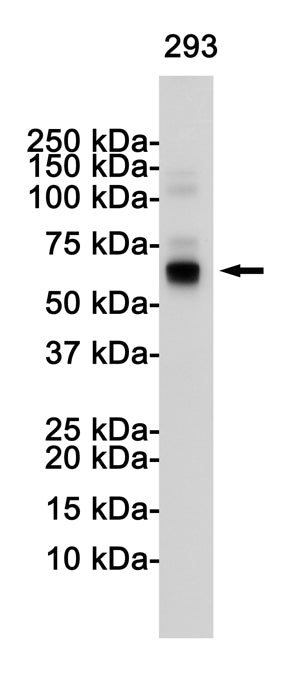 Anti-S6K1 Rabbit Monoclonal Antibody