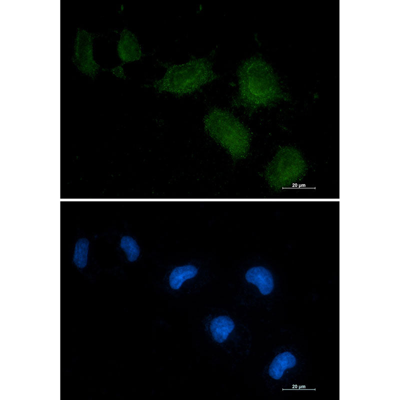 Anti-Vitamin D Binding Protein Rabbit Monoclonal Antibody